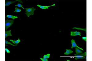 Immunofluorescence of monoclonal antibody to TUBA1B on HeLa cell. (TUBA1B antibody  (AA 1-451))