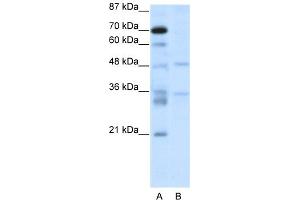 WB Suggested Anti-HTLF Antibody Titration:  2. (FOXN2 antibody  (C-Term))