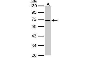 alpha 2 Antiplasmin antibody  (Center)