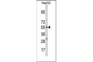 Image no. 1 for anti-Cytochrome P450, Family 11, Subfamily A, Polypeptide 1 (CYP11A1) (N-Term) antibody (ABIN360271) (CYP11A1 antibody  (N-Term))