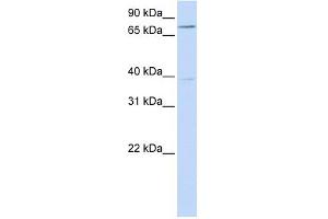 C17ORF80 antibody used at 1 ug/ml to detect target protein. (HLC8 antibody  (N-Term))