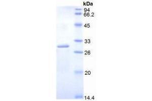 SDS-PAGE analysis of Mouse DLAT Protein. (DLAT Protein)