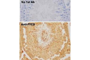 Immunohistochemistry (IHC) image for anti-Formiminotransferase Cyclodeaminase (FTCD) (N-Term) antibody (ABIN6254252) (FTCD antibody  (N-Term))
