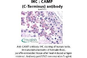 Image no. 1 for anti-Cathelicidin Antimicrobial Peptide (CAMP) (C-Term) antibody (ABIN1732585) (Cathelicidin antibody  (C-Term))