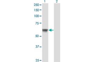 Western Blot analysis of ATP6AP1 expression in transfected 293T cell line by ATP6AP1 monoclonal antibody (M02), clone 3B11. (ATP6AP1 antibody  (AA 51-150))