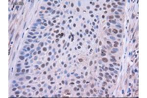 Image no. 6 for anti-Epithelial Cell Adhesion Molecule (EPCAM) (AA 24-265) antibody (ABIN1491256)