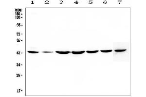 Western blot analysis of FLIP using anti-FLIP antibody (ABIN5693075).