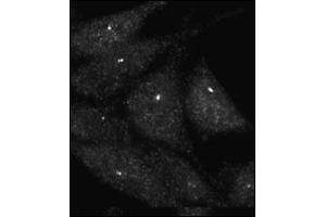 Immunofluorescence staining of Autophagy UVRAG antibody (ABIN388586 and ABIN2849984) on Methanol-fixed HeLa cells.