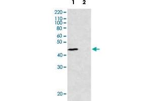 Immunoprecipitation of rad51 in yeast whole cell extracts. (RAD51 antibody)
