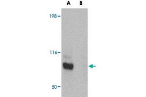 Western blot analysis of JPH3 in Daudi cell lysate with JPH3 polyclonal antibody  at 1 ug/mL in (A) the absence and (B) the presence of blocking peptide. (Junctophilin 3 antibody  (C-Term))