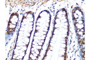 Immunohistochemistry of paraffin-embedded human colon using PP1 beta Rabbit mAb (ABIN1679819, ABIN3018859, ABIN3018860 and ABIN7101675) at dilution of 1:100 (40x lens).