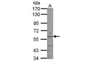 Image no. 2 for anti-IKAROS Family Zinc Finger 2 (IKZF2) (AA 263-504) antibody (ABIN1498849) (IKZF2 antibody  (AA 263-504))