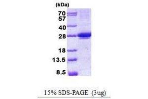 Figure annotation denotes ug of protein loaded and % gel used. (MIS12 Protein)