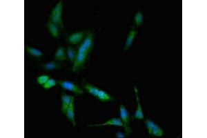 Immunofluorescent analysis of Hela cells using ABIN7171654 at dilution of 1:100 and Alexa Fluor 488-congugated AffiniPure Goat Anti-Rabbit IgG(H+L) (TBC1D4 antibody  (AA 1-94))