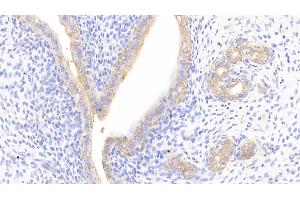 Detection of CTTN in Rat Uterus Tissue using Polyclonal Antibody to Cortactin (CTTN) (Cortactin antibody  (AA 1-509))
