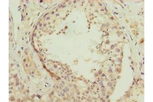 Immunohistochemistry of paraffin-embedded human testis tissue using ABIN7166731 at dilution of 1:100 (NSUN7 antibody  (AA 1-300))