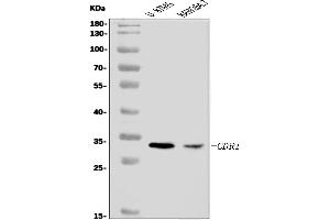 Western blot analysis of CDR1 using anti-CDR1 antibody (ABIN7599007).