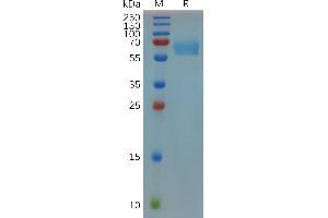 SDS-PAGE (SDS) image for CD27 Molecule (CD27) (AA 24-182) protein (Fc Tag) (ABIN7092856)