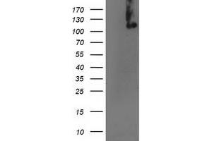 Western Blotting (WB) image for anti-Excision Repair Cross-Complementing Rodent Repair Deficiency, Complementation Group 4 (ERCC4) antibody (ABIN1498073) (ERCC4 antibody)