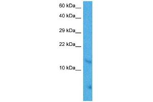 Host:  Mouse  Target Name:  MAX  Sample Tissue:  Mouse Brain  Antibody Dilution:  1ug/ml (MAX antibody  (Middle Region))