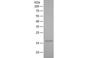 Fibroblast Growth Factor 2 (Basic) (FGF2) (AA 143-288) (Active) protein (His tag)