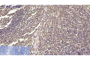 Immunohistochemistry of paraffin-embedded Human tonsil tissue using CD68 Monoclonal Antibody at dilution of 1:200. (CD68 antibody)