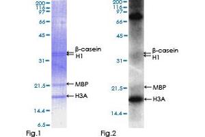 Western Blotting (WB) image for Vaccinia Related Kinase 2 (VRK2) (AA 1-508) protein (GST tag) (ABIN1325113) (VRK2 Protein (AA 1-508) (GST tag))