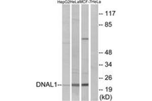 Western blot analysis of extracts from HeLa/HepG2/MCF-7 cells, using DNAL1 Antibody. (DNAL1 antibody  (AA 121-170))
