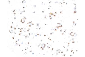 Immunocytochemistry (ICC) image for anti-ThPok (AA 250-300) antibody (ABIN7455169) (Recombinant ThPok (AA 250-300) antibody)