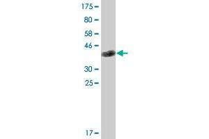 Western Blot detection against Immunogen (36. (EML1 antibody  (AA 1-99))