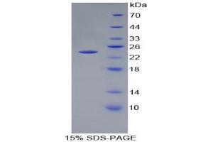 SDS-PAGE (SDS) image for Peptidoglycan Recognition Protein 1 (PGLYRP1) (AA 22-196) protein (His tag) (ABIN1879810) (PGLYRP1 Protein (AA 22-196) (His tag))