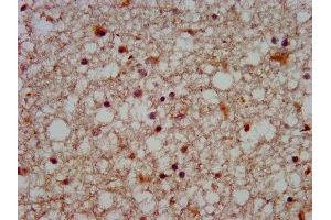 IHC image of ABIN7170083 diluted at 1:500 and staining in paraffin-embedded human brain tissue performed on a Leica BondTM system. (KCC2 antibody  (AA 944-1071))