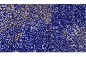 Detection of Bid in Rat Spleen Tissue using Polyclonal Antibody to BH3 Interacting Domain Death Agonist (Bid) (BID antibody  (AA 1-195))