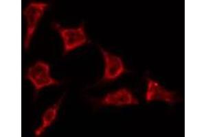 ABIN6278329 staining HepG2 by IF/ICC. (REM1 antibody  (N-Term))