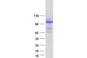 Validation with Western Blot