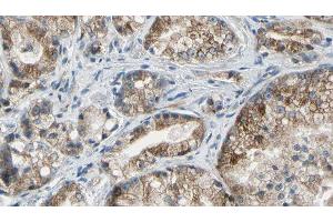 ABIN6277530 at 1/100 staining Human prostate tissue by IHC-P. (Golgin A2 (GOLGA2) (N-Term) antibody)