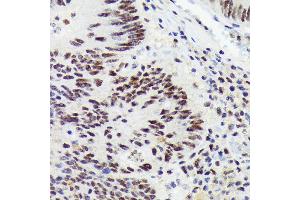 Immunohistochemistry of paraffin-embedded human colon carcinoma using RNF40 Rabbit mAb (ABIN7270074) at dilution of 1:100 (40x lens). (RNF40 antibody)