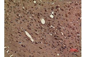 Immunohistochemistry (IHC) image for anti-Chemokine (C-X3-C Motif) Receptor 1 (CX3CR1) (Internal Region) antibody (ABIN6281049)