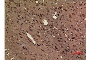 Immunohistochemistry (IHC) analysis of paraffin-embedded Rat Brain, antibody was diluted at 1:100. (CX3CR1 antibody  (Internal Region))