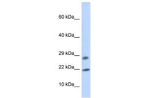 OCIAD2 antibody used at 1 ug/ml to detect target protein. (OCIAD2 antibody  (Middle Region))