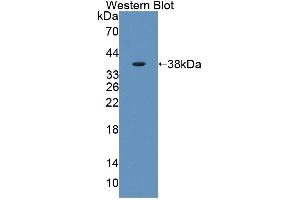 Detection of Recombinant PLSCR4, Human using Polyclonal Antibody to Phospholipid Scramblase 4 (PLSCR4) (PLSCR4 antibody  (AA 1-303))