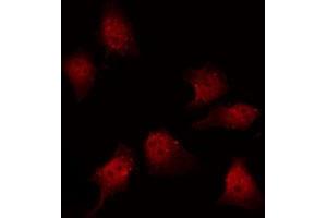 ABIN6267459 staining K562 by IF/ICC. (ENOS antibody  (pThr495))