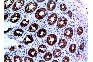 Immunohistochemistry (IHC) analysis of paraffin-embedded Human Colon, antibody was diluted at 1:100. (KRT8 antibody  (Ser726, Ser731))