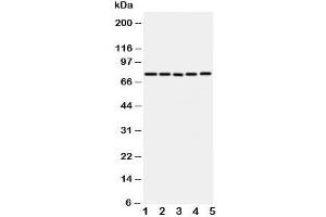 Western blot testing of ABCG1 antibody and Lane 1:  U87;  2: SMMC-7721;  3: HeLa;  4: COLO320;  5: MCF-7 cell lysate. (ABCG1 antibody  (C-Term))