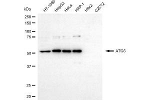 Western blotting analysis using ATG5 antibody (ABIN7797673). (ATG5 antibody)