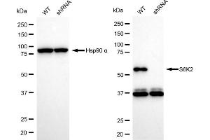 Western blotting analysis using S6K2 antibody (ABIN7800227). (Recombinant RPS6KB2 antibody)