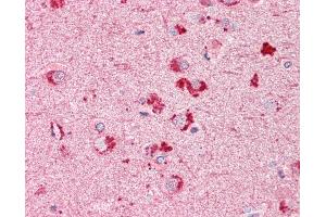 Anti-RIF1 antibody IHC of human brain, cortex. (RIF1 antibody  (AA 2076-2089))