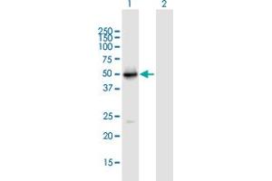 Western Blot analysis of VDR expression in transfected 293T cell line by VDR MaxPab polyclonal antibody. (Vitamin D Receptor antibody  (AA 1-427))