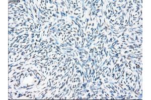 Immunohistochemical staining of paraffin-embedded colon tissue using anti-PPP5Cmouse monoclonal antibody. (PP5 antibody)