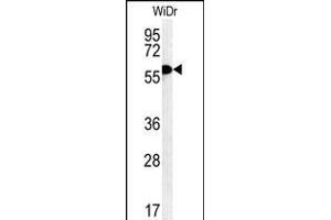 TANK Antibody (Center) (ABIN652041 and ABIN2840515) western blot analysis in WiDr cell line lysates (35 μg/lane). (TANK antibody  (AA 88-114))